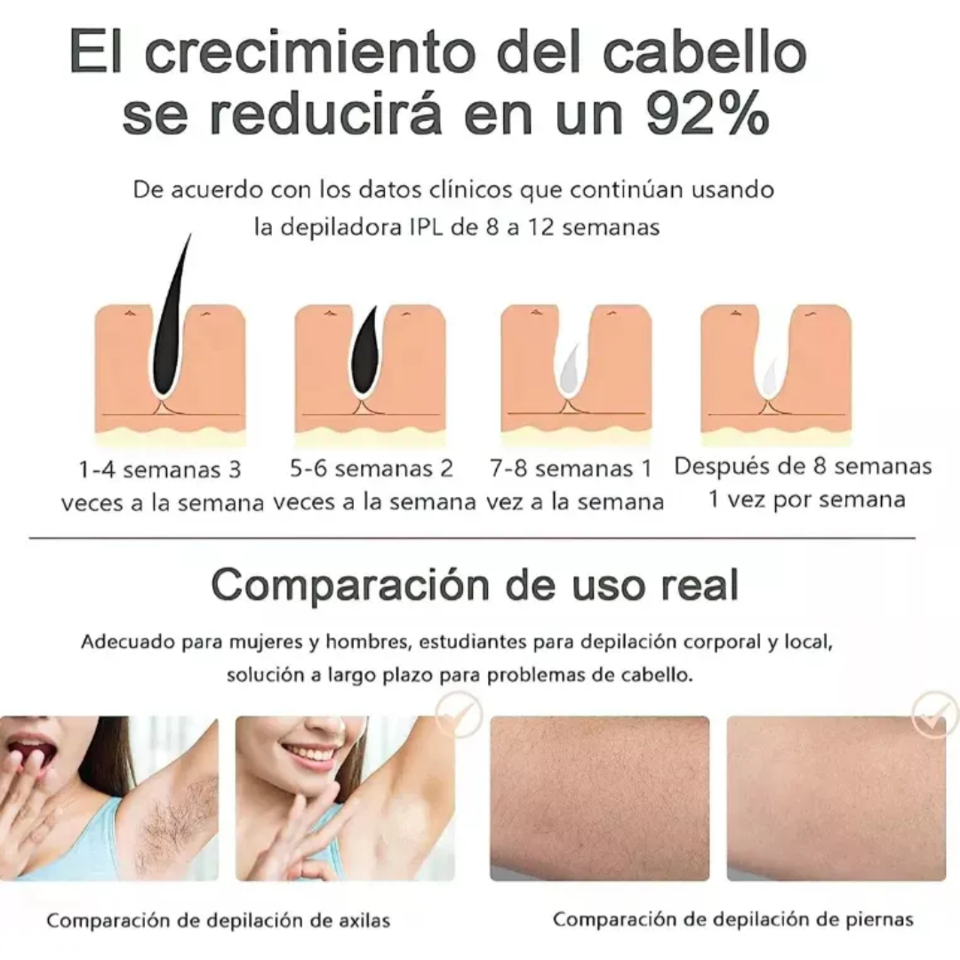 Luce una piel perfecta sin citas ni dolor. Depiladora IPL